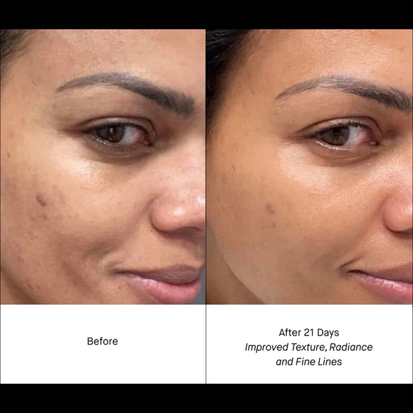 Shani Darden Retinol Reform Serum - Picture 4 of 9